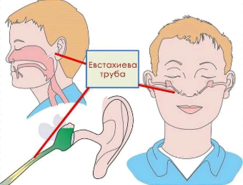 Заложен нос ухо болит голова. Слуховая евстахиева труба. Слуховая евстахиева труба соединяет.