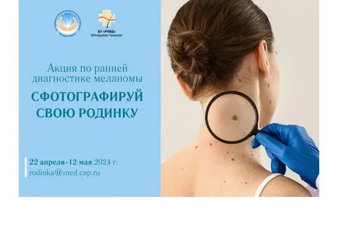 Дерматолог удаляет папилломы