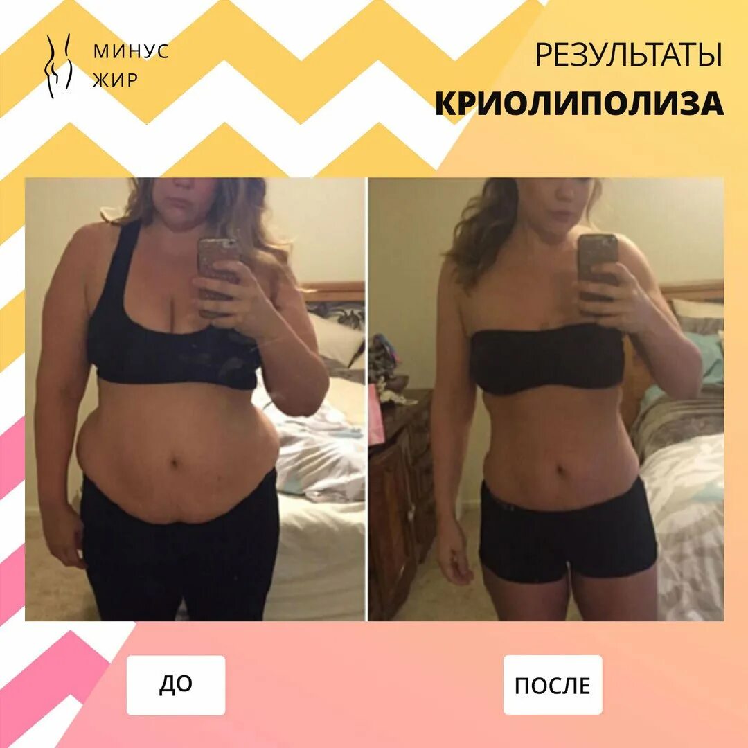 Результат от обруча до и после. Тело до и после планки. Похудение до и после месяц. Калланетика фото до и после. Похудение до и после.