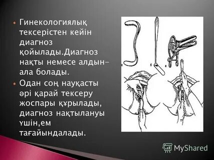 Олардың төрт аяқтап тұрған суреті