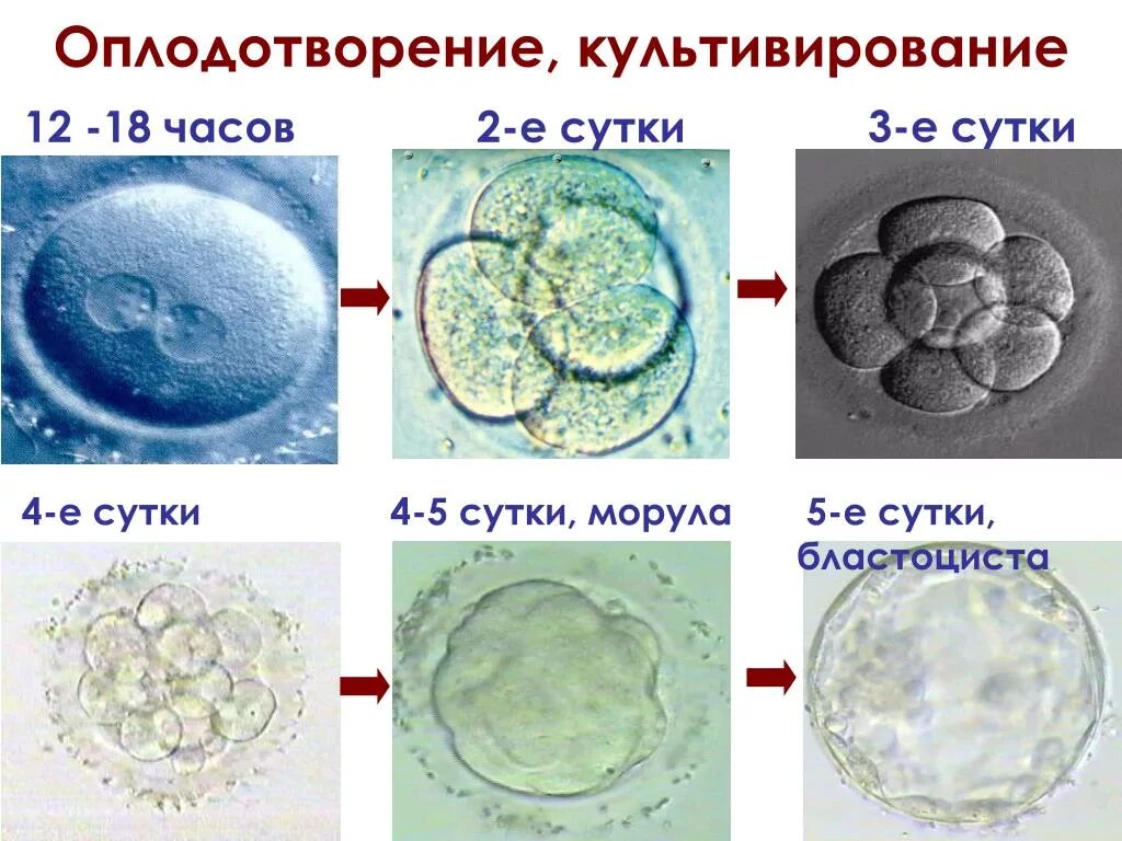 Эмбрион после пересадки. Зигота морула бластоциста. Кавитирующая морула. Бластоциста морула эмбрион. Эко стадии развития эмбриона.