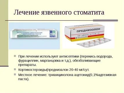 Обезболивающее от стоматита во рту