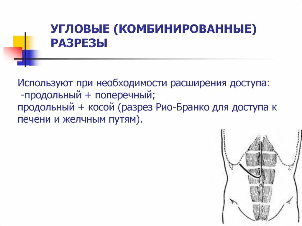 Ревизия брюшной полости при проникающих ранениях. Комбинированные разрезы. Разрез косой продольный комбинированный. Угловой разрез хирургия. Продольный и поперечный разрез в хирургии.