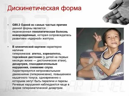 Дцп поражение