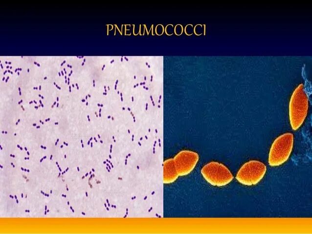 Streptococcus pneumoniae haemophilus influenzae streptococcus. Стафилококки стрептококки пневмококки. streptococcus pneumoniae микробиология. пневмококки морфология.
