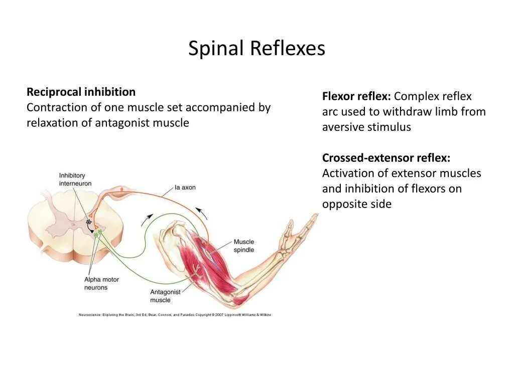 Reflex Arc Complex. Spinal Reflex. Flexor Reflex. Crossed extensor Reflex.