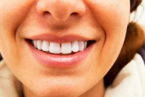 Smile зубы