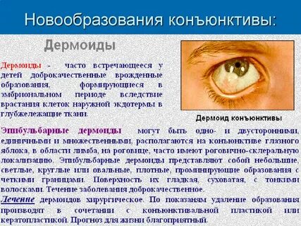 Конъюнктива век