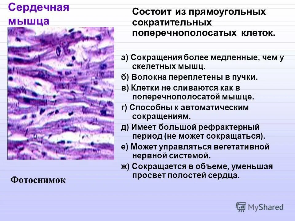 поперечнополосатые мышечные клетки образуют. поперечнополосатые мышечные клетки образуют. поперечнополосатые мышечные клетки образуют. поперечно полосатая сердечная мышечная ткань функции. поперечно полосатая скелетная ткань.