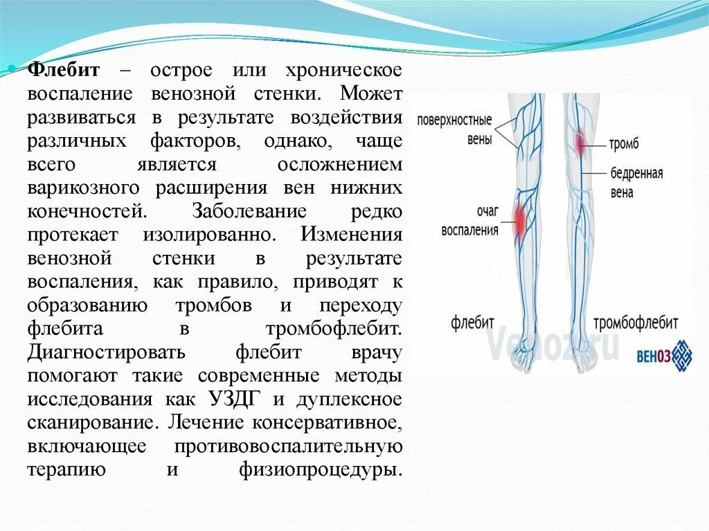 Тромбофлебит карта вызова. Флебит и тромбофлебит нижних конечностей. Флебит поверхностной бедренной вены. Воспаление венозной стенки.