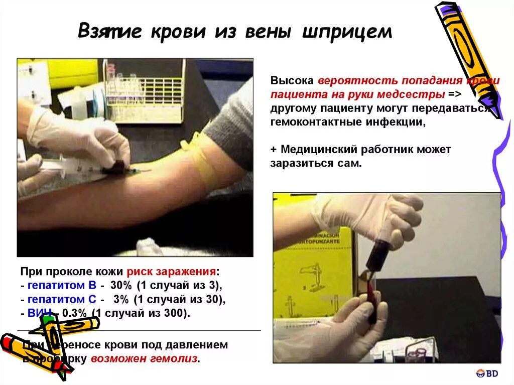Забор анализов алгоритм. Шприц для забора крови из вены. забор крови из вены алгоритм. взятие крови из вены алгоритм. методика забора крови из вены.