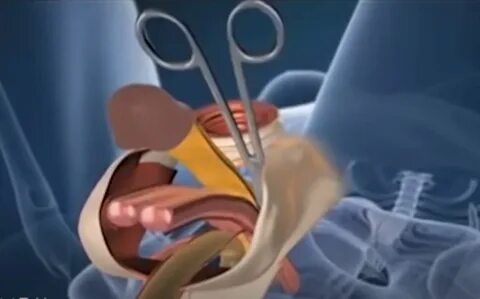 Eshaklarning toliq ekranli fotosuratlari