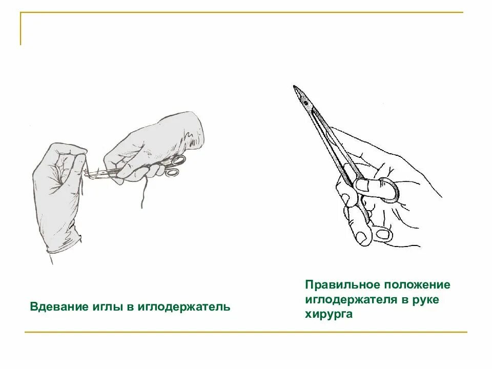 Как держать иглу. Позиция иглодержателя в руке хирурга. Способы подачи хирургических инструментов. Способы подачи стерильных инструментов хирургу. Положение иглодержателя в руке.