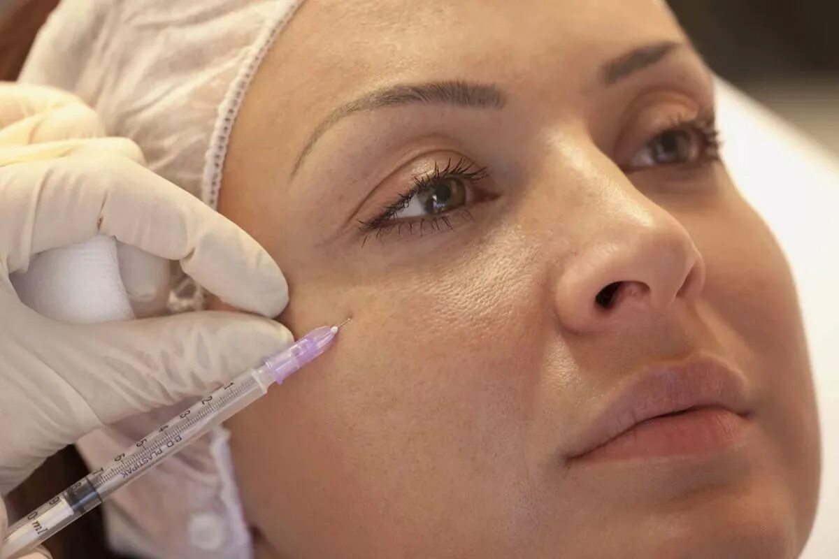 пройти мезотерапию. тициано биоревитализация. биоревилитация эффект. безинъекционная лазерная биоревитализация. косметология мезотерапия.