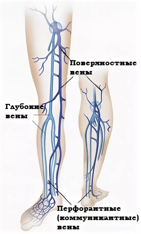 Тромбоз бедренных вен. Перфорантные вены нижних конечностей анатомия. Суральные вены нижних конечностей анатомия. Тромбофлебит бедренной вены.