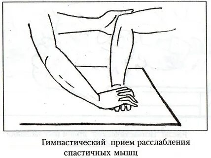 Инсульт упражнения для правой руки
