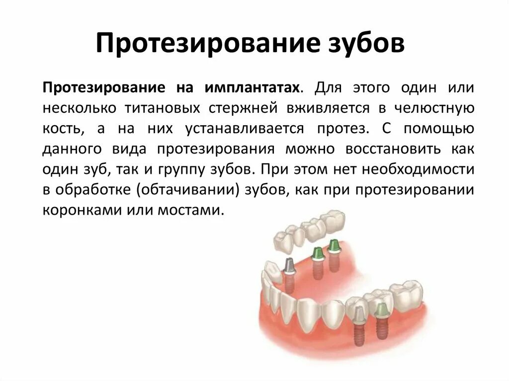 Протезирование зубов инвалиду 1 группы. Методы протезирования зубов. Протезирование зубов схема.