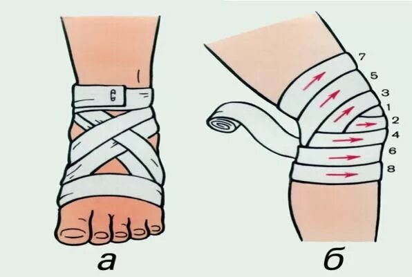 Восьмиобразная повязка на стопу алгоритм. Бинтовать колено эластичным бинтом. Восьмиобразная повязка накладывается на голеностопный сустав при. Восьмиобразная повязка на голеностопный сустав алгоритм.