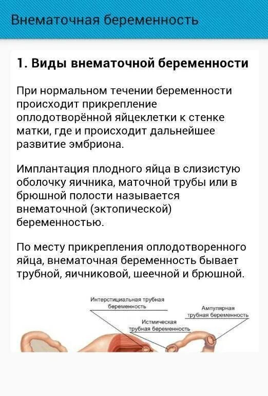 Внематочная беременность операция сроки. Внематочная беременность симптомы на ранних. Внематочная беременность симптомы. Симптомы вне внематочной беременности. Клиника внематочной беременности на раннем сроке.