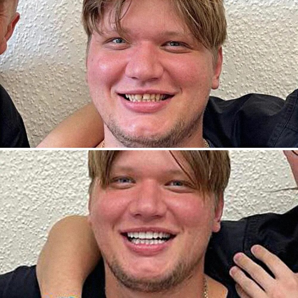 Что случилось с симплом