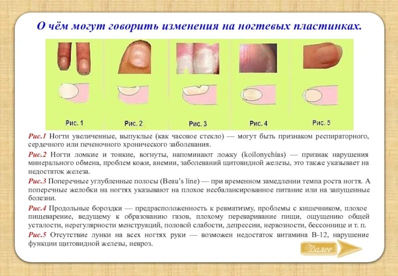 Изменение будет скажите. Заболевания ногтевой пластины.