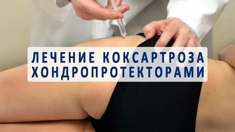 Уколы при коксартрозе 2 степени