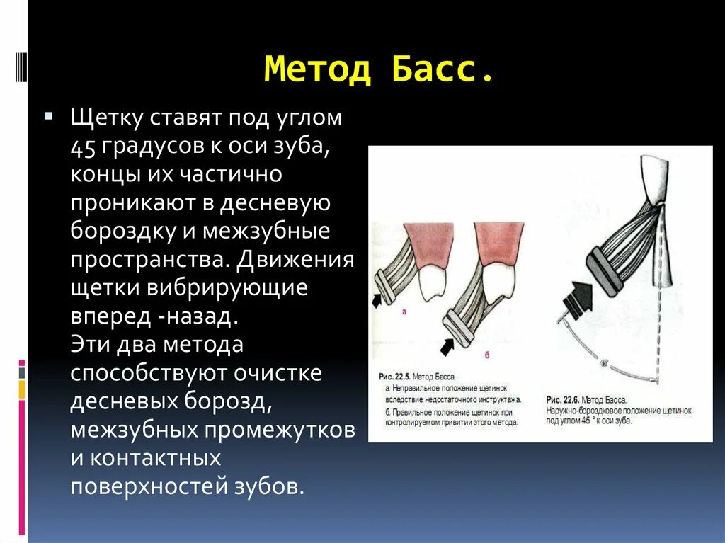 Метод басса чистка. Метод басса чистка зубов. Метод басс. Алгоритм чистки зубов методом басса.