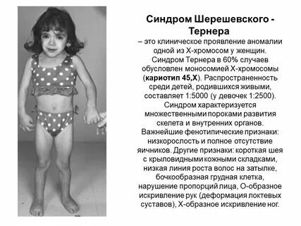Что такое болезнь х