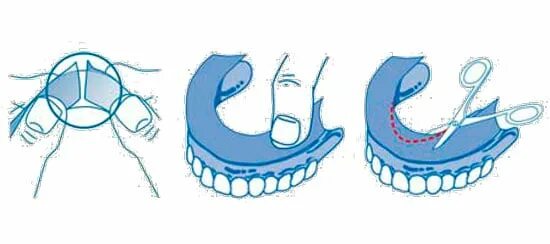 Прокладки для фиксации зубных. Фиксирующие вкладыши fittydent super denture adhesive cushions, 15 штук. зубной протез с подкладкой. прокладки для зубных протезов. прокладки на протезы зубов.