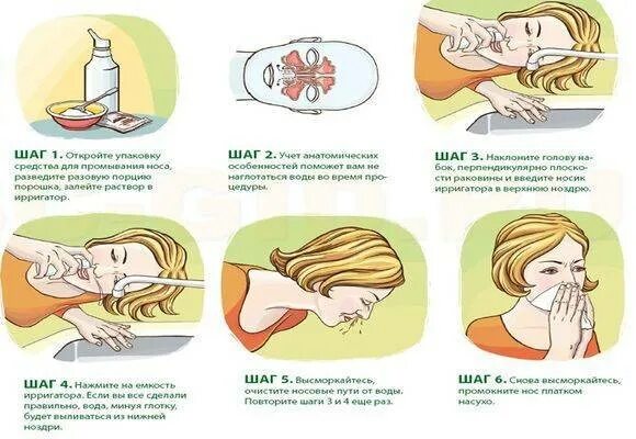 Можно ли промывать нос при заложенности носа. Солевой раствор раствор для промывания носа. Раствор для промывания носа домашний как сделать. Как правильно сделать соляной раствор для промывания носа. Соляная вода промывать нос.
