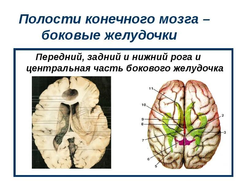 Боковые желудочки головного мозга анатомия. Отделы боковых желудочков конечного мозга. Нижний Рог бокового желудочка. Конечный мозг желудочки мозга. Правый желудочек головного