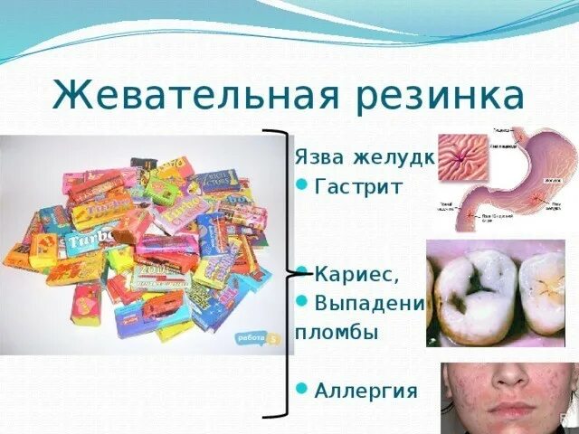 Можно жевательную резинку жевать. Жевательная резинка в желудке. жевать жвачку. влияние жевательная резинка на жкт. вред жевательной резинки.