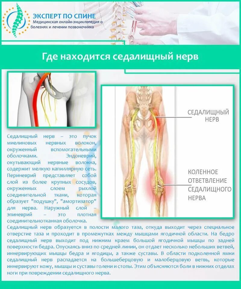 Как проявляется седалищный нерв симптомы. Седалищный нерв схема. защемление седалищного нерва. защемило седалищный нерв симптомы. ветви седалищного нерва анатомия.