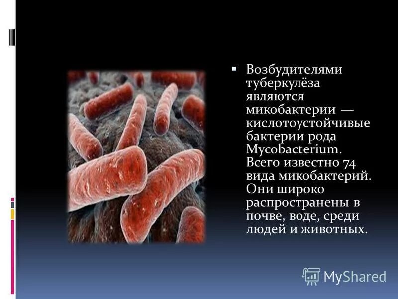 Туберкулёз возбудитнль. Туберкулёзная палочка таксономия. Микобактерии возбудители туберкулеза. Этиология возбудителя туберкулеза. Mycobacterium tuberculosis таксономия.