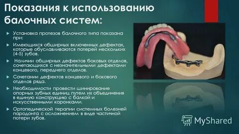 Показания к протезированию