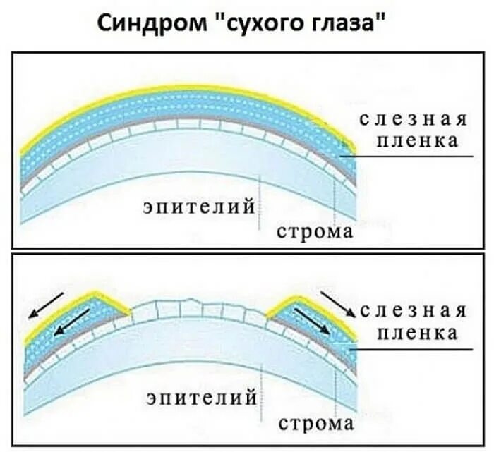 Почему возникает синдром сухого глаза. Слезная пленка глаза строение. строение слезной пленки. три слоя слезной пленки.