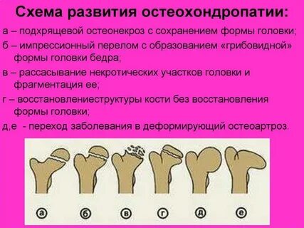 Кости у детей лечение