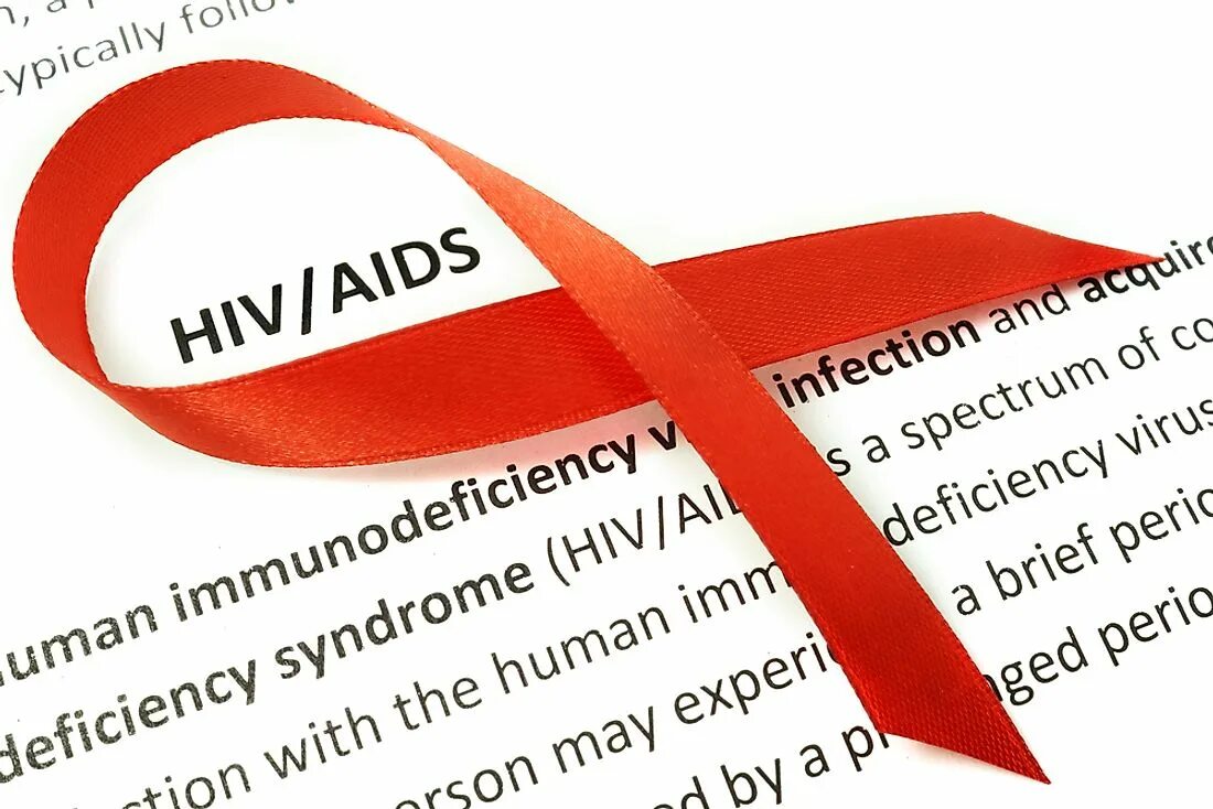 HIV AIDS. СПИД. ВИЧ. СПИД изображение.