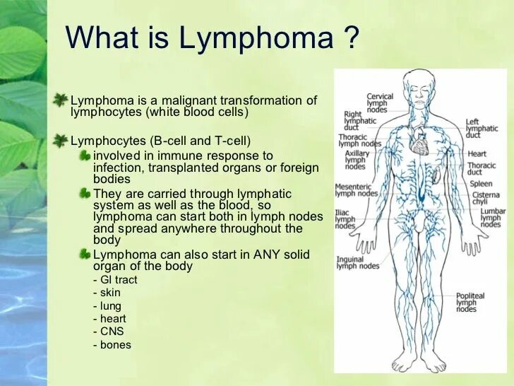 Лимфома брюшной. Lymphoma латынь.