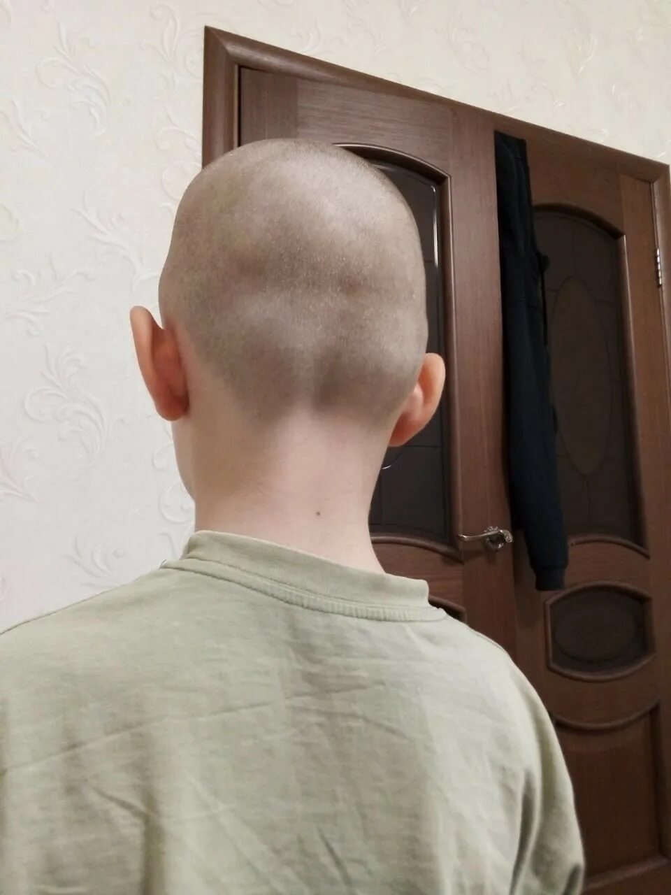 Мужской затылок лысый. Лысая голова. Мужской затылок лысый. Точка vb20 - фэн-чи. Затылок фото.