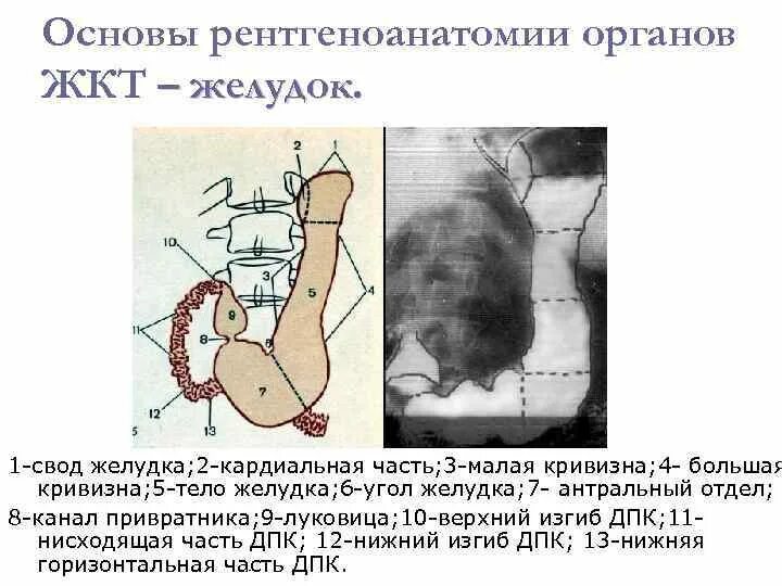 Кардиальный латынь. Рентгеноанатомическая номенклатура желудка. Желудок тонкий кишечник рентгеноанатомия. Отделы желудка рентгеноанатомия. Рентгенанатомия желудка.