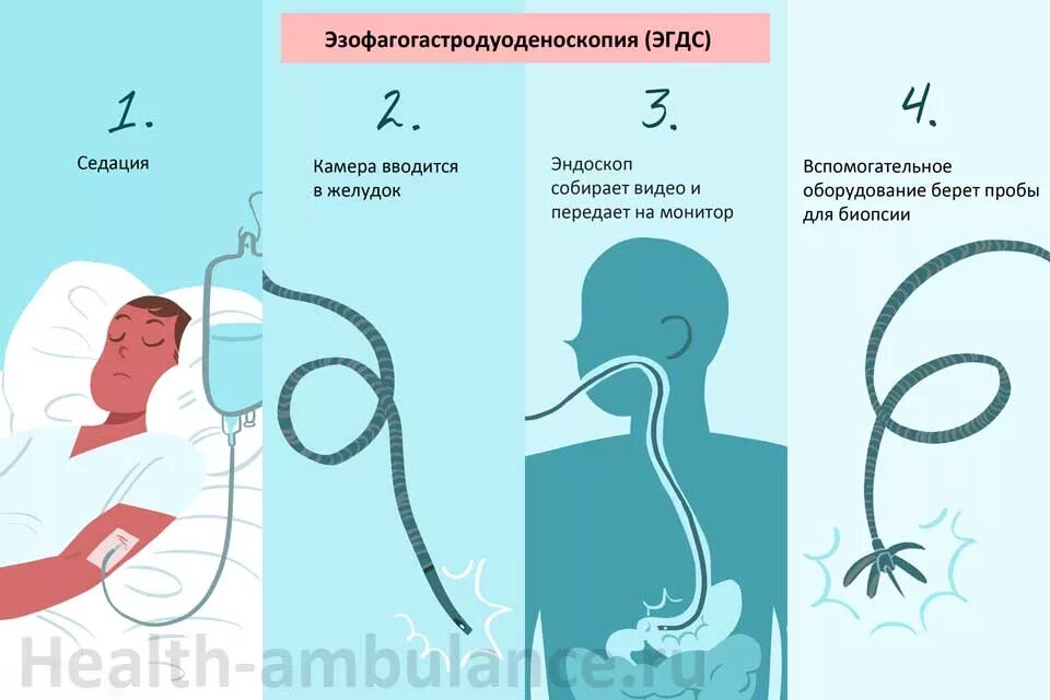 Подготовка фгдс желудка взрослого человека с утра. ФГДС подготовка к обследованию пациентов. Подготовка пациента к ЭГДС. Подготовка пациента к фибро гастро дуодено скопия. Подготовка к ЭГДС памятка.