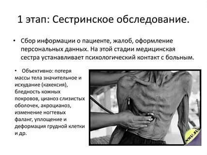 Помощь больному туберкулезом