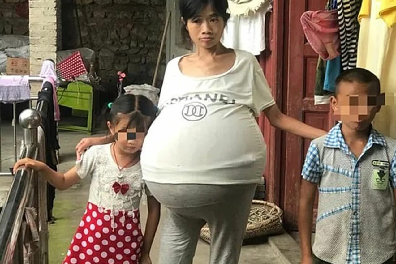 полный живот. у девочки был большой живот. животик у женщин. малыш в животике. тинг фианхэ.