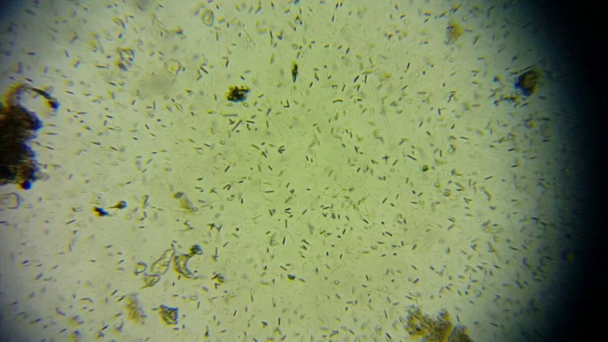 Life in a drop of water from a puddle. Episode 003 beta - YouTube