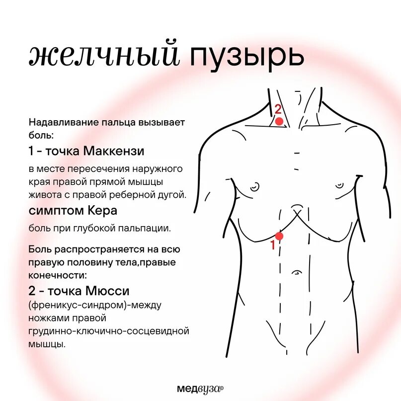 Болевые точки и зоны желчного пузыря. Болевые точки при заболеваниях ЖКТ. Болевые точки при заболеваниях желчного пузыря. Болевые точки при болезнях желчного пузыря.