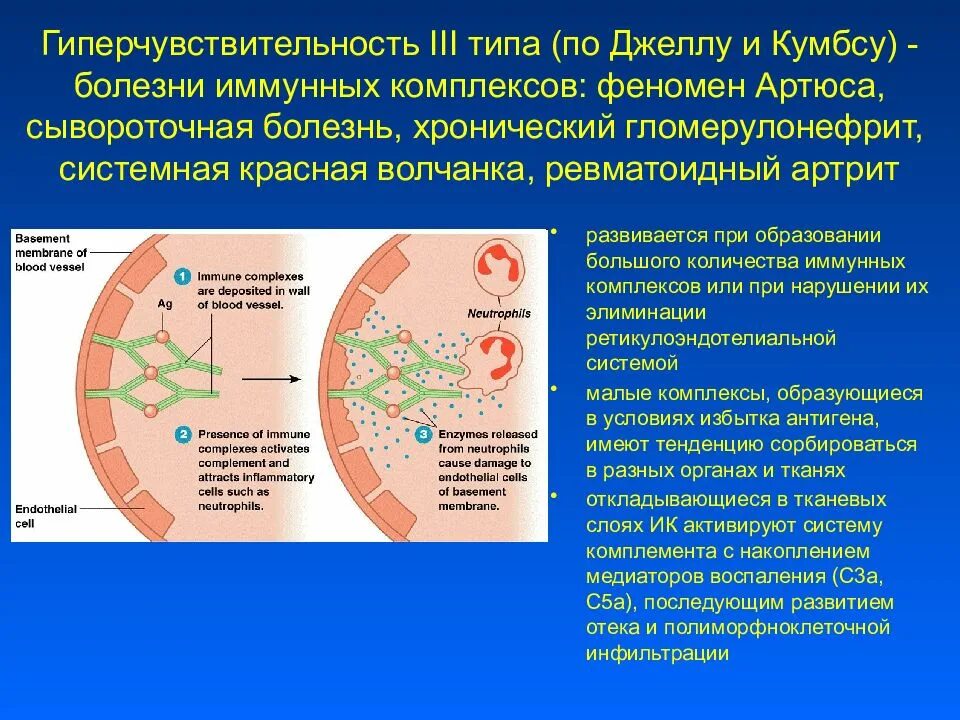 Иммунная гиперчувствительность. Сывороточная болезнь. Феномен Артюса. Болезни иммунных комплексов. Типы гиперчувствительности болезни. Гиперчувствительность III типа.