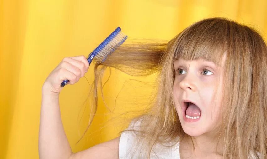 сифилитическая алопеция (облысение). ломкие волосы у ребенка. девочке 8 лет выпадают волосы. девочка с волосами. гнёздная (очаговая алопеция).