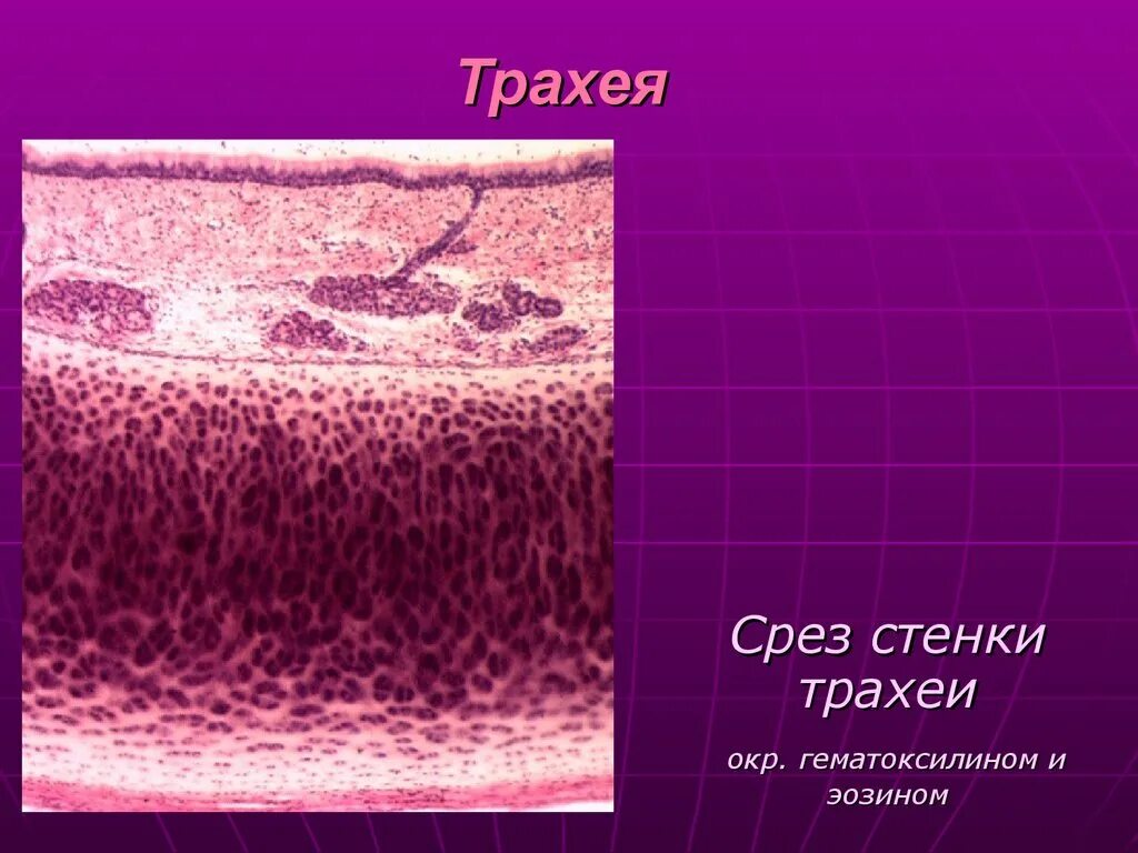 Трахея гистологический. Срез трахеи гистология препарат. препарат трахея поперечный срез. трахея гистология препарат. трахея собаки гистология.