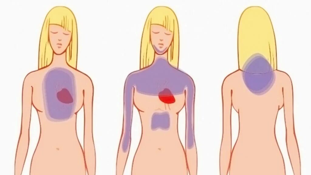 Как понять где болит. Как болит сердце. локализация боли в сердце. локализация боли в груди. как понять что болит сердце.